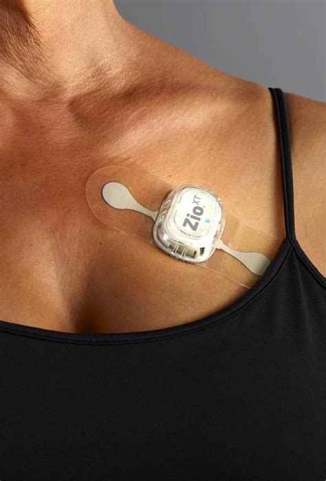 continuous cardiac monitoring Zio patch that helps prevent atrial fibrillation. . Does the zio patch vibrate